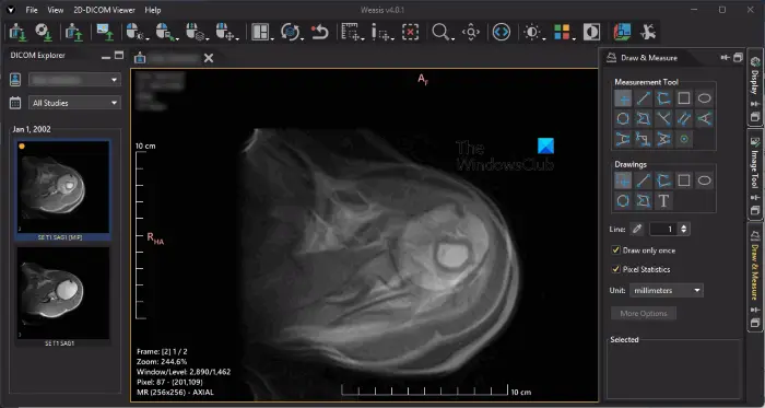 Weasis free DICOM Viewer software